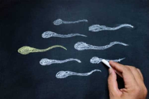 Male Infertility of Testicular Origin