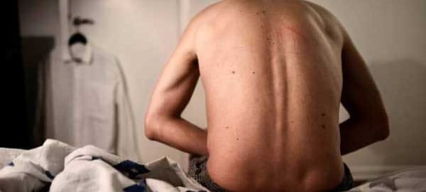 Premature Ejaculation