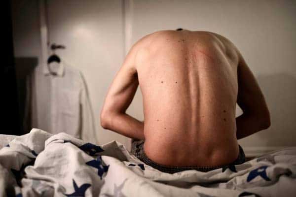 Premature Ejaculation